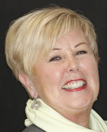 Happy dental veneers patient in Twickenham